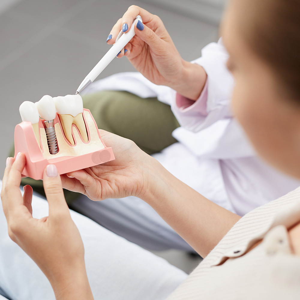 A dental professional demonstrates dental implant preparation, holding an open mouth model with surgical tools and a drill.