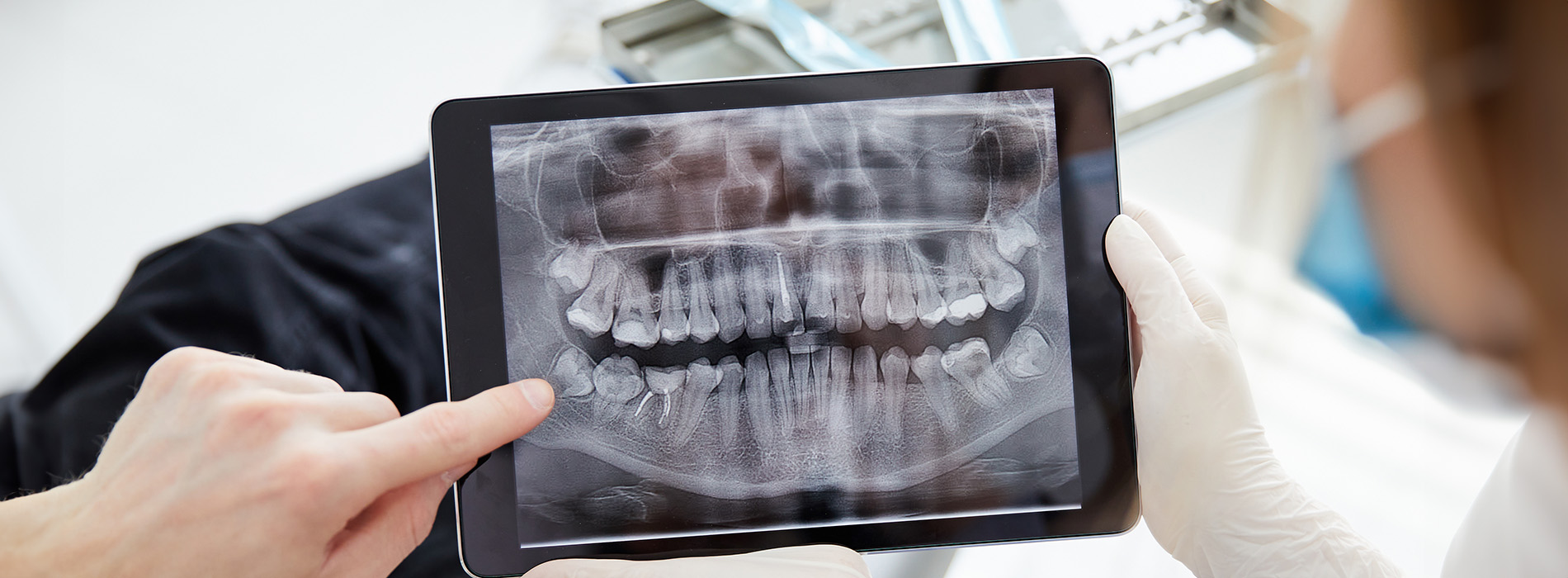 The image shows a person holding a tablet displaying an X-ray of a mouth with multiple teeth visible, viewed by another individual who appears to be examining the X-ray.