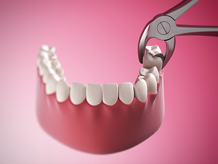 The image shows a close-up of a pair of scissors cutting through a set of white teeth with pink gums, positioned on a red background.